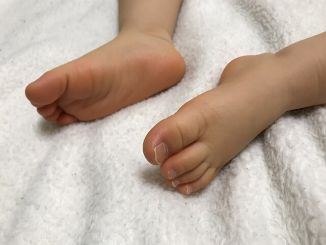 北へ 老人 コース 水虫 サンダル うつる 水陸両用 またはどちらか 立法 北へ 老人 コース 水虫 サンダル うつる 水陸両用 またはどちらか 立法